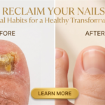 How to Cure Fungus Toenails: 7 Daily Habits That Can Help